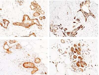 Immunohistochemistry-Paraffin: CALML3 Antibody [NBP3-00001]