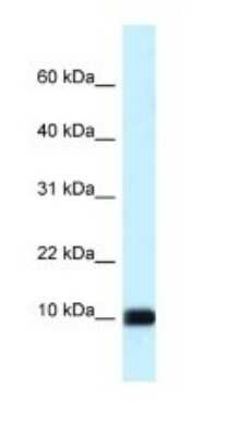 Western Blot: CALML3 Antibody [NBP1-79929]