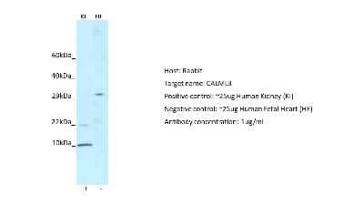 Western Blot: CALML3 Antibody [NBP1-79929]