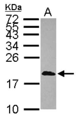 Western Blot: CALML3 Antibody [NBP2-15667]