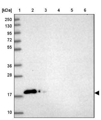 Western Blot: CALML3 Antibody [NBP2-33434]