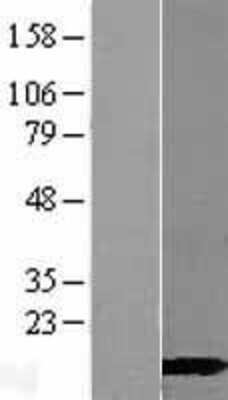 Western Blot: CALML3 Overexpression Lysate [NBL1-08652]