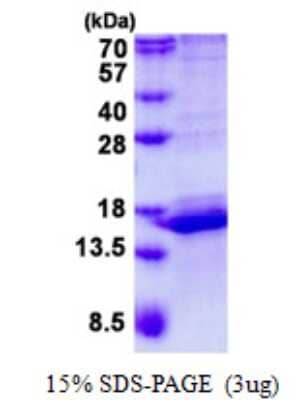 SDS-PAGE: Recombinant Human CALML3 His Protein [NBP2-22726]