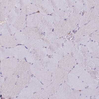 Immunohistochemistry-Paraffin: CALML4 Antibody [NBP2-14434]