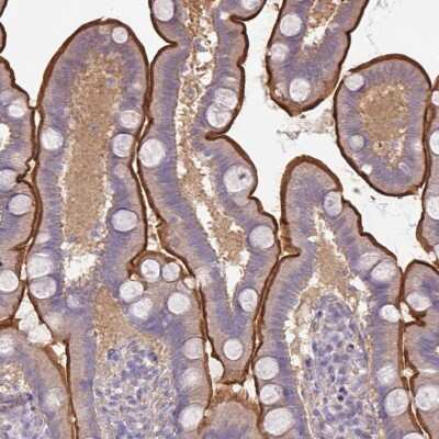 Immunohistochemistry-Paraffin: CALML4 Antibody [NBP2-14434]