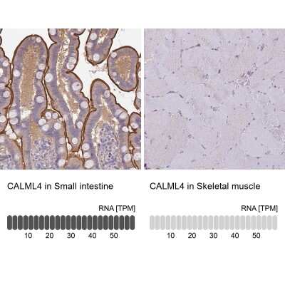 Immunohistochemistry-Paraffin: CALML4 Antibody [NBP2-14434]