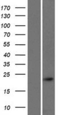 Western Blot: CALML4 Overexpression Lysate [NBP2-05882]