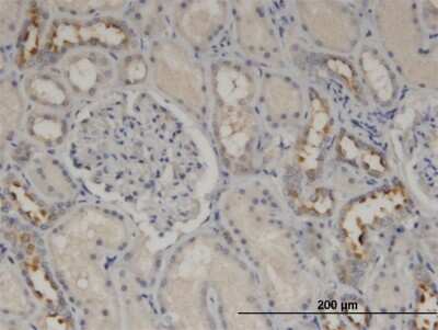 Immunohistochemistry-Paraffin: CALML5 Antibody (2F10) [H00051806-M16]