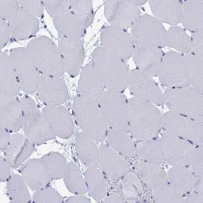 Immunohistochemistry-Paraffin: CALML5 Antibody [NBP1-84437]