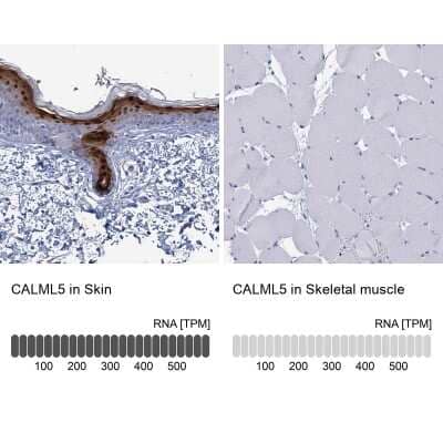 Immunohistochemistry-Paraffin: CALML5 Antibody [NBP1-84437]