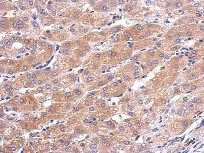 Immunohistochemistry-Paraffin: CALML5 Antibody [NBP2-15668]