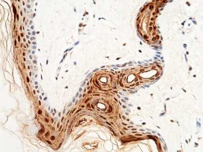 Immunohistochemistry-Paraffin: CALML5 Antibody [NBP2-99872]