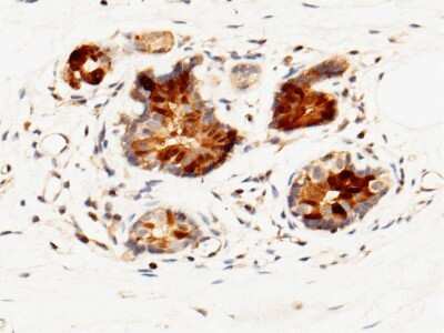 Immunohistochemistry-Paraffin: CALML5 Antibody [NBP2-99872]