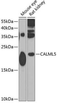 Western Blot: CALML5 AntibodyBSA Free [NBP2-92815]