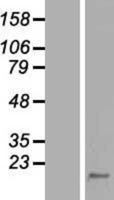 Western Blot: CALML5 Overexpression Lysate [NBL1-08653]