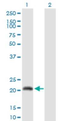 Western Blot: CALML6 Antibody [H00163688-D01P]