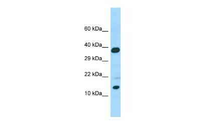 Western Blot: CALML6 Antibody [NBP2-86594]