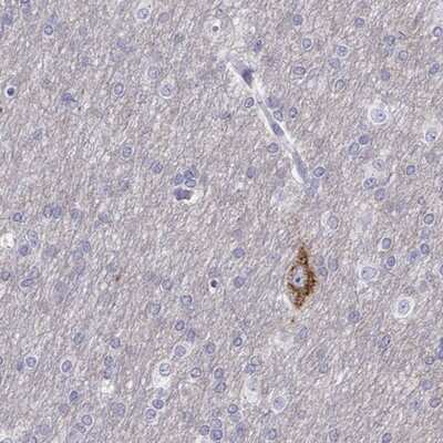 Immunohistochemistry-Paraffin: CALY Antibody [NBP1-91225]