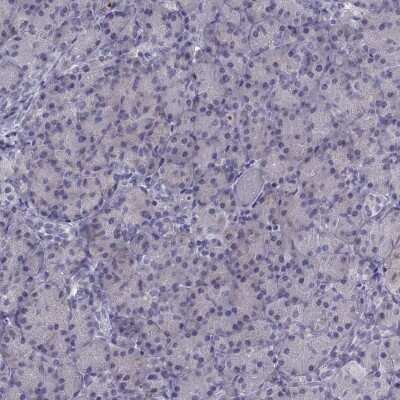 Immunohistochemistry-Paraffin: CALY Antibody [NBP1-91225]