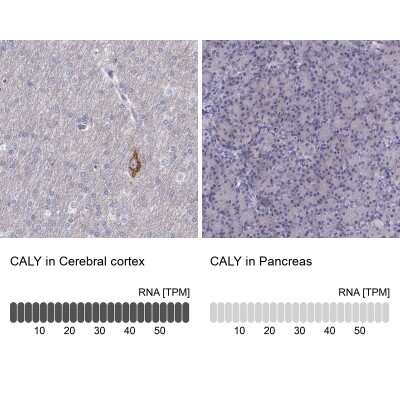 Immunohistochemistry-Paraffin: CALY Antibody [NBP1-91225]