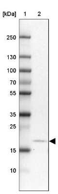 Western Blot: CALY Antibody [NBP1-91225]