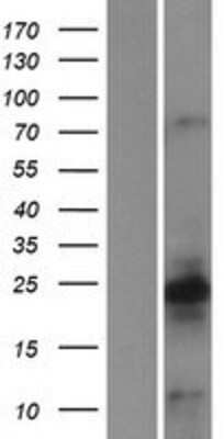 Western Blot: CALY Overexpression Lysate [NBP2-07122]