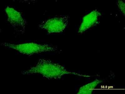 Immunocytochemistry/ Immunofluorescence: CAMKID Antibody (3H8) [H00057118-M10]