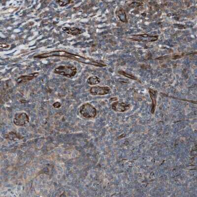 Immunohistochemistry-Paraffin: CAMKID Antibody [NBP1-85589]