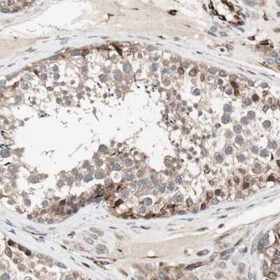 Immunohistochemistry-Paraffin: CAMKID Antibody [NBP1-85589]