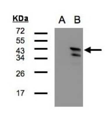 Western Blot: CAMKID Antibody [NBP1-31478]