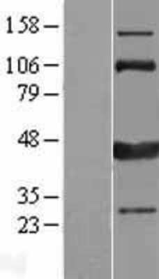 Western Blot: CAMKID Overexpression Lysate [NBL1-08659]