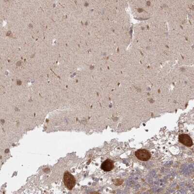 Immunohistochemistry-Paraffin: CAMLG Antibody [NBP2-33661]
