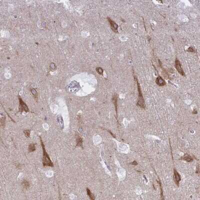 Immunohistochemistry-Paraffin: CAMLG Antibody [NBP2-33789]