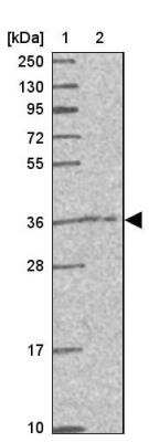 Western Blot: CAMLG Antibody [NBP2-33661]