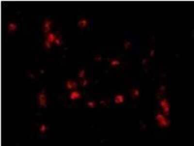 Immunocytochemistry/ Immunofluorescence: CAMP/LL37/FALL39/Cathelicidin Antibody - BSA Free [NBP1-76864]