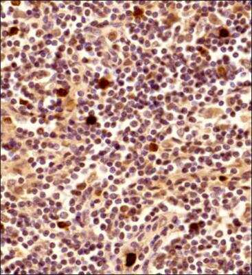 Immunohistochemistry-Paraffin: CAMP/LL37/FALL39/Cathelicidin Antibody - BSA Free [NBP1-76864]