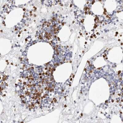 Immunohistochemistry-Paraffin: CAMP/Cathelicidin Antibody [NBP1-88203]