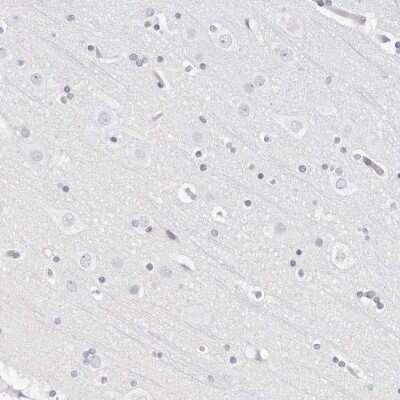 Immunohistochemistry-Paraffin: CAMP/Cathelicidin Antibody [NBP1-88203]