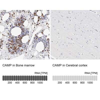 Immunohistochemistry-Paraffin: CAMP/Cathelicidin Antibody [NBP1-88203]