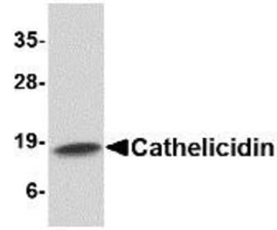 Western Blot: CAMP/LL37/FALL39/Cathelicidin AntibodyBSA Free [NBP1-76864]