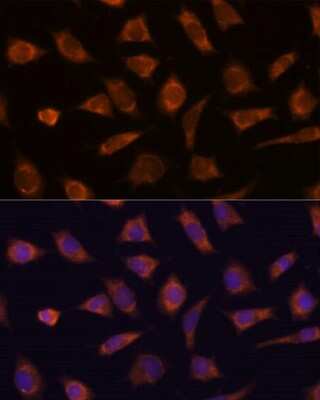 Immunocytochemistry/ Immunofluorescence: CAMSAP1 Antibody - Azide and BSA Free [NBP3-15553]
