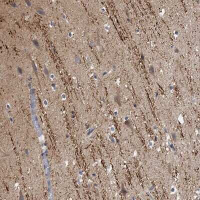 Immunohistochemistry-Paraffin: CAMSAP1 Antibody [NBP1-84193]