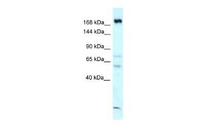 Western Blot: CAMSAP1 Antibody [NBP2-87121]