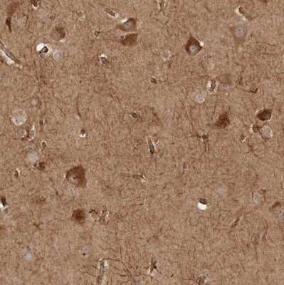 Immunohistochemistry-Paraffin: CAMSAP1L1 Antibody [NBP1-82933]