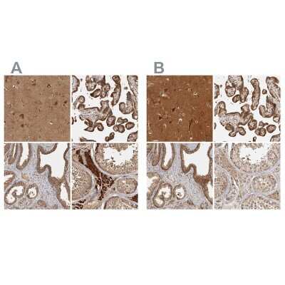 Immunohistochemistry-Paraffin: CAMSAP1L1 Antibody [NBP1-82933]