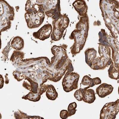 Immunohistochemistry-Paraffin: CAMSAP1L1 Antibody [NBP1-82933]