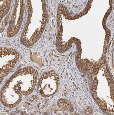 Immunohistochemistry-Paraffin: CAMSAP1L1 Antibody [NBP1-82933]