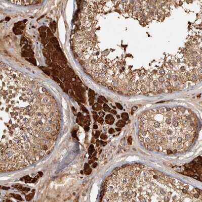 Immunohistochemistry-Paraffin: CAMSAP1L1 Antibody [NBP1-82933]