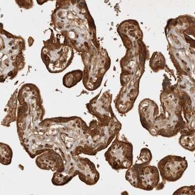 Immunohistochemistry-Paraffin: CAMSAP1L1 Antibody [NBP1-82934]