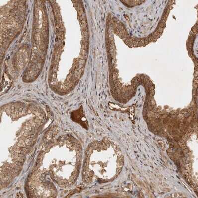 Immunohistochemistry-Paraffin: CAMSAP1L1 Antibody [NBP1-82934]